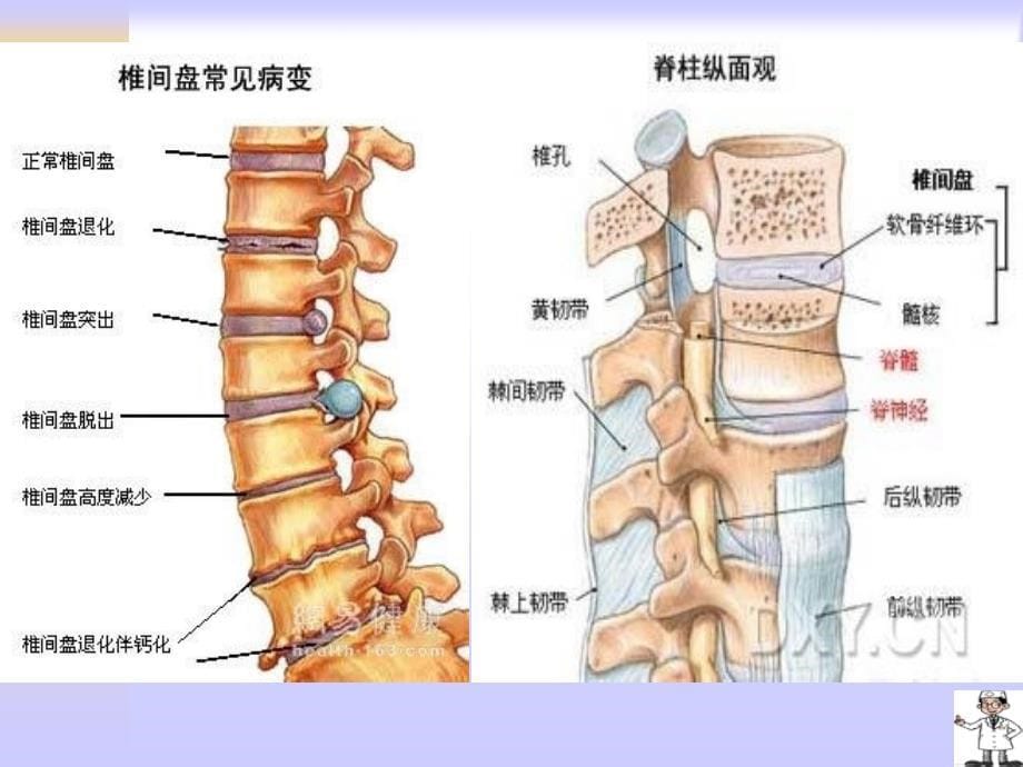 腰椎间盘突出症及颈椎病_第5页