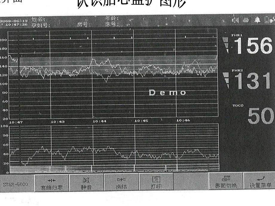 胎心监护ppt课件_第4页