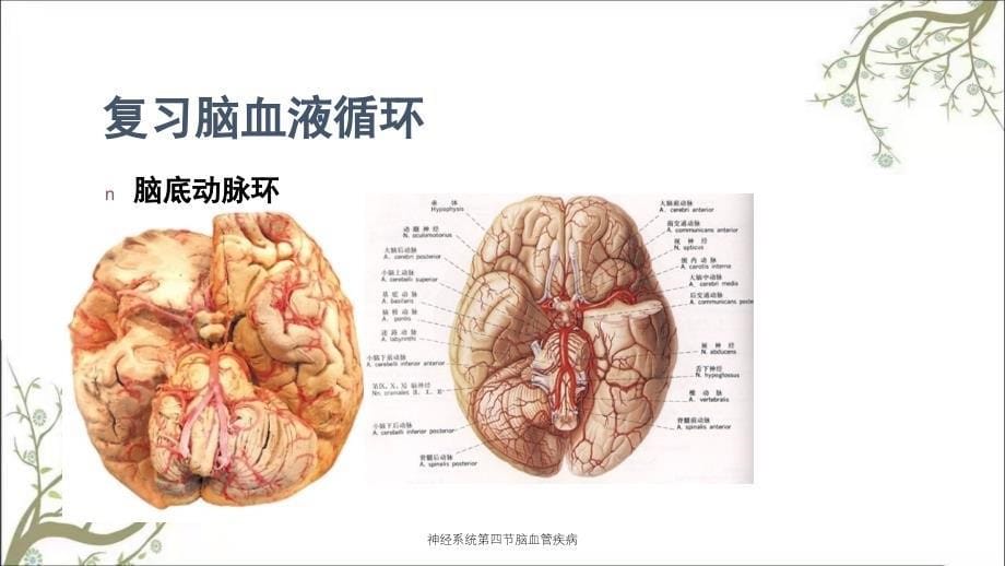 神经系统第四节脑血管疾病_第5页