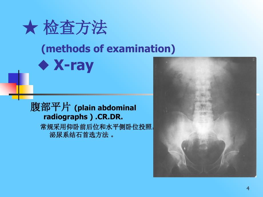 泌尿系统与肾上腺参考PPT_第3页