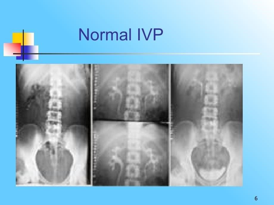 泌尿系统与肾上腺参考PPT_第5页