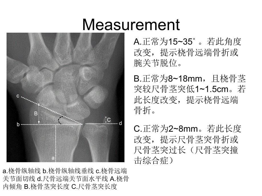 腕关节X线解剖ppt课件_第5页