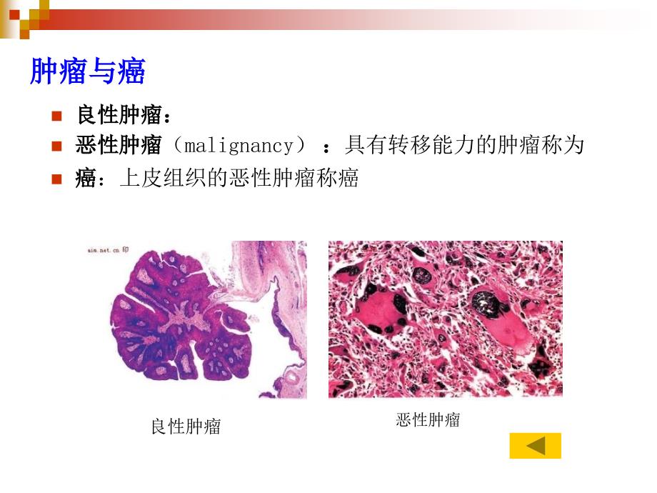 第二节癌细胞Cancercell_第3页