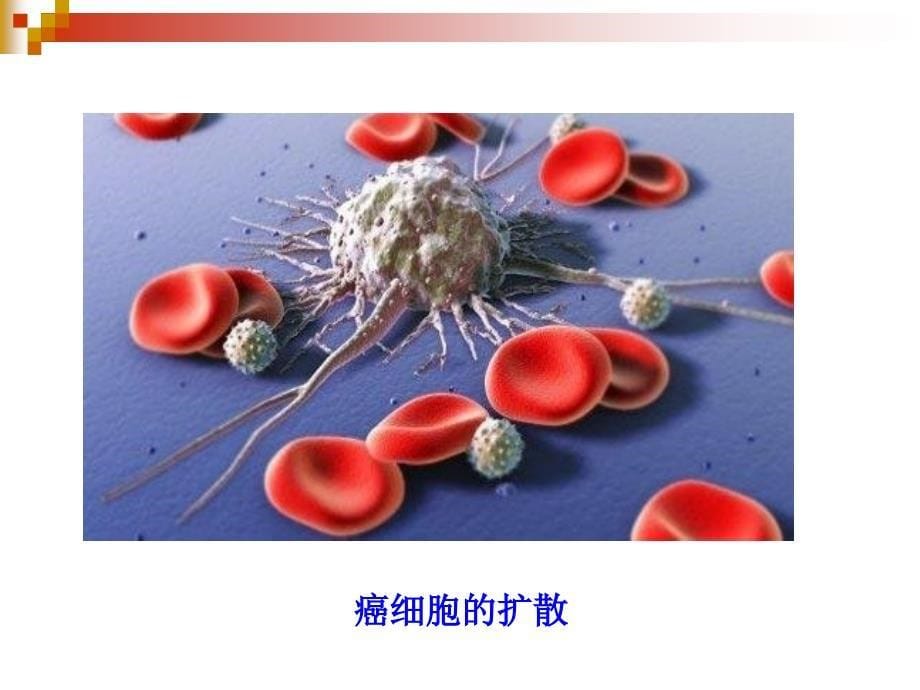 第二节癌细胞Cancercell_第5页