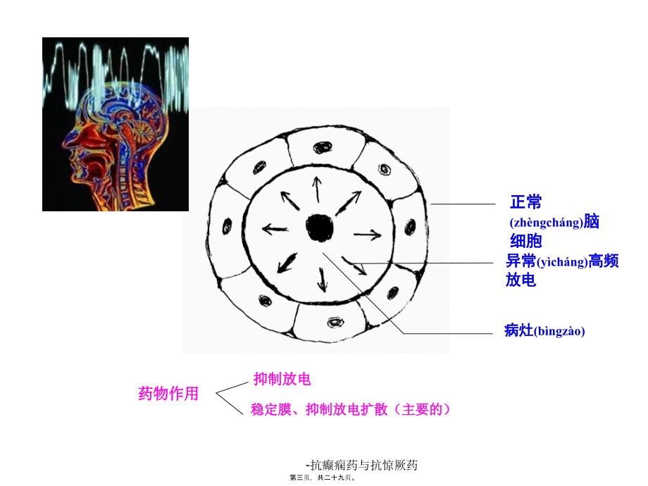 -抗癫痫药与抗惊厥药课件_第3页