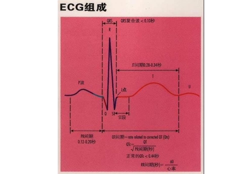 看图识心电PPT课件_第2页