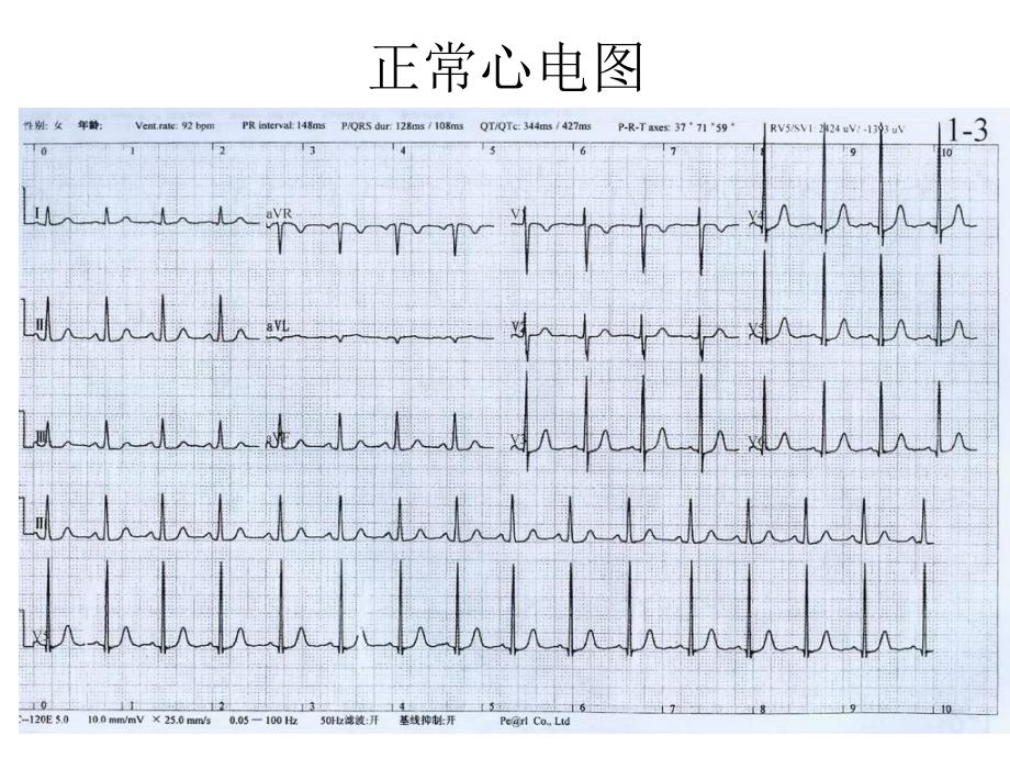 看图识心电PPT课件_第4页