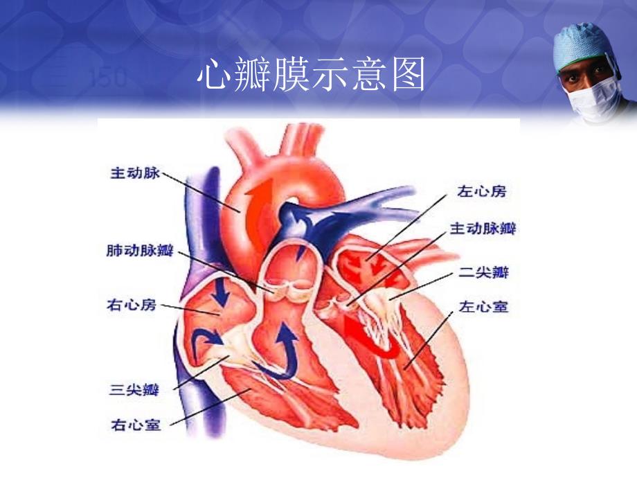 二尖瓣病变体征_第3页