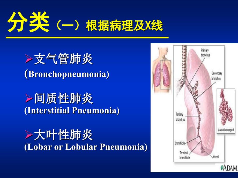 《肺炎的诊断及治疗》PPT课件_第4页