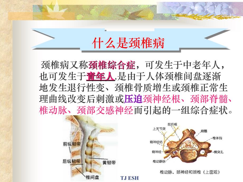 教师保健颈椎ppt课件_第2页