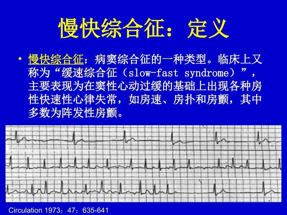 慢快综合征vs快慢综合征治疗策略选择ppt课件_第5页