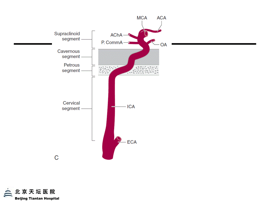 《脑血管定位诊断》PPT课件_第4页