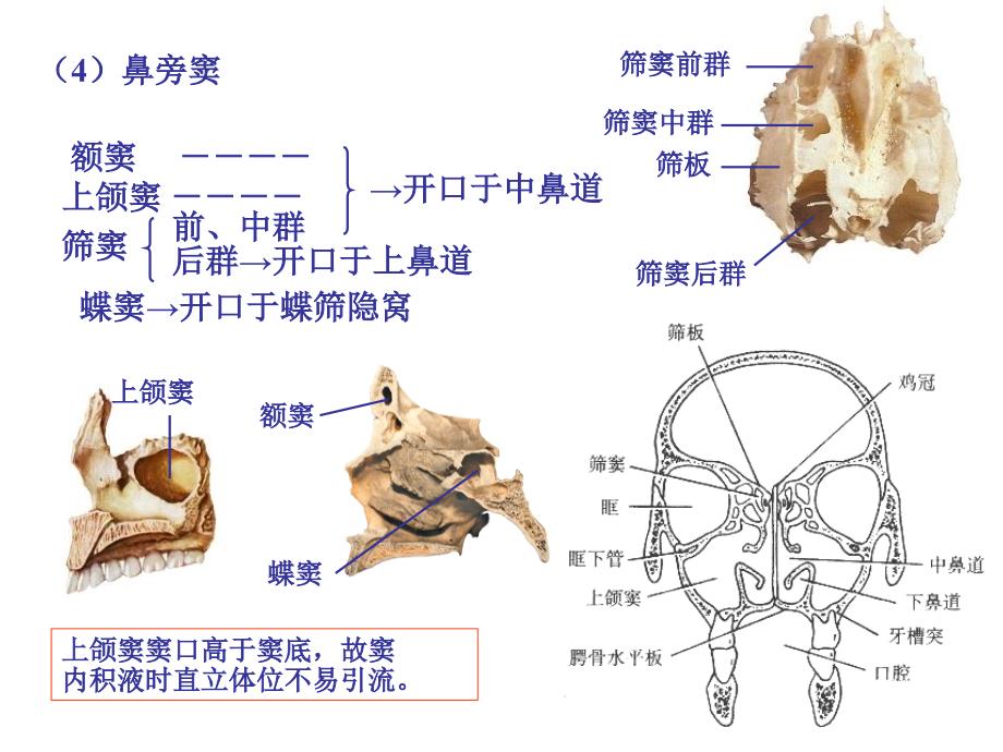 颅脑影像解剖与病变3_第2页