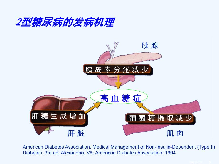 糖尿病及降糖药物ppt医学课件_第5页