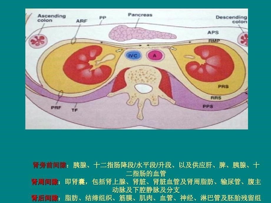 腹膜后原发肿瘤CT_第5页