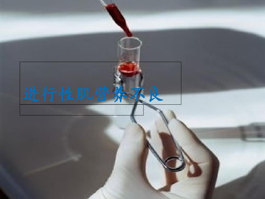 进行性肌营养不良_第1页