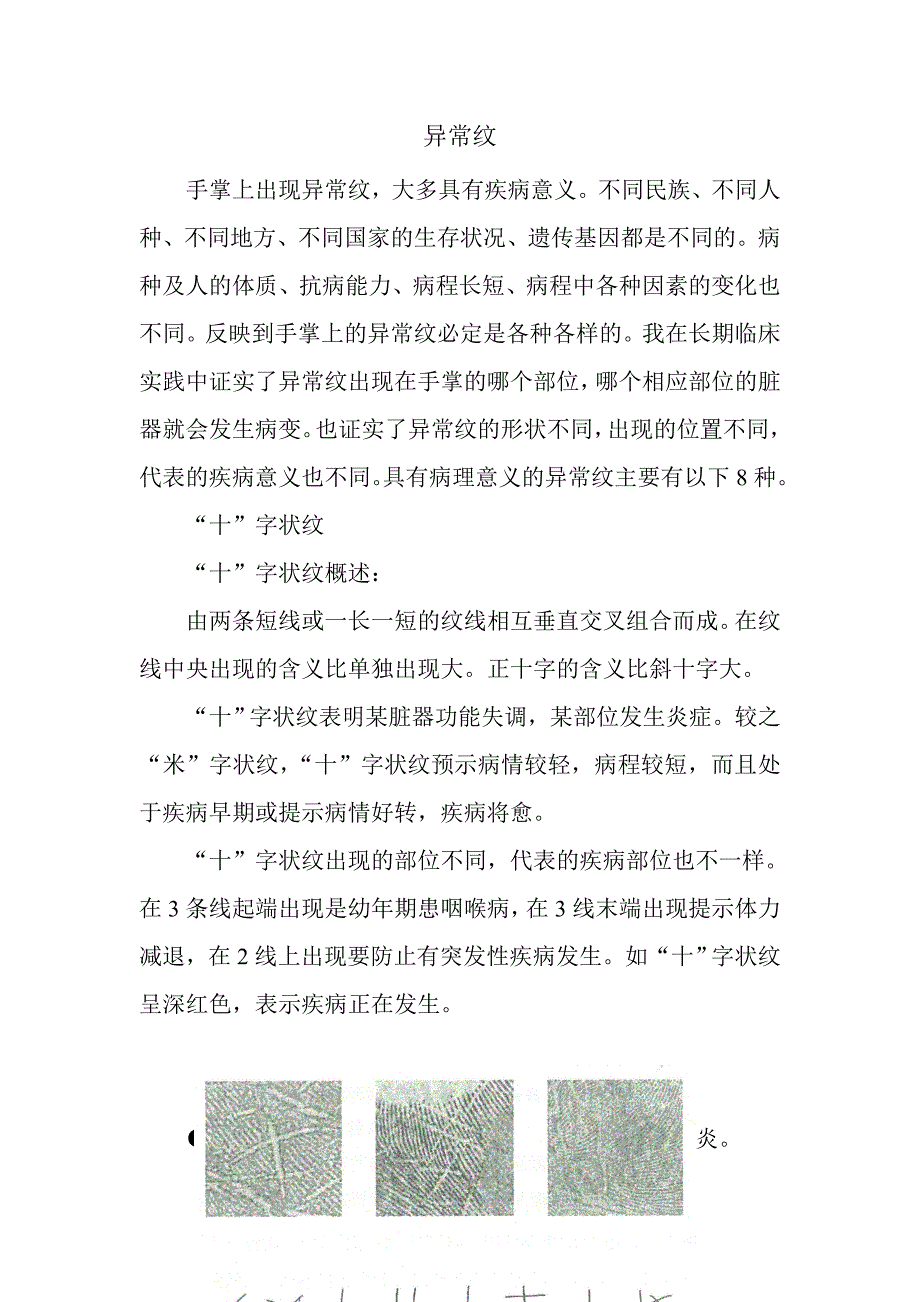 手掌上出现异常纹_第1页