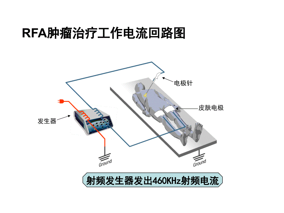 射频消融技术与射频消融肿瘤治疗设备_第4页