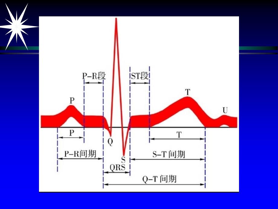 心电学基本知识通用课件_第3页