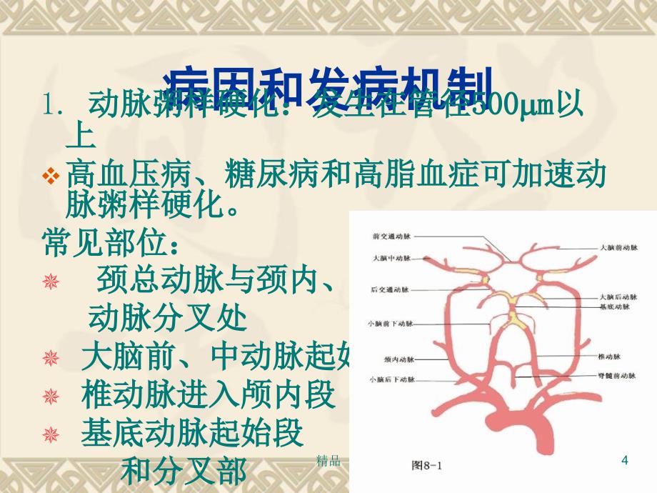 脑梗死诊断影像学治疗_第4页