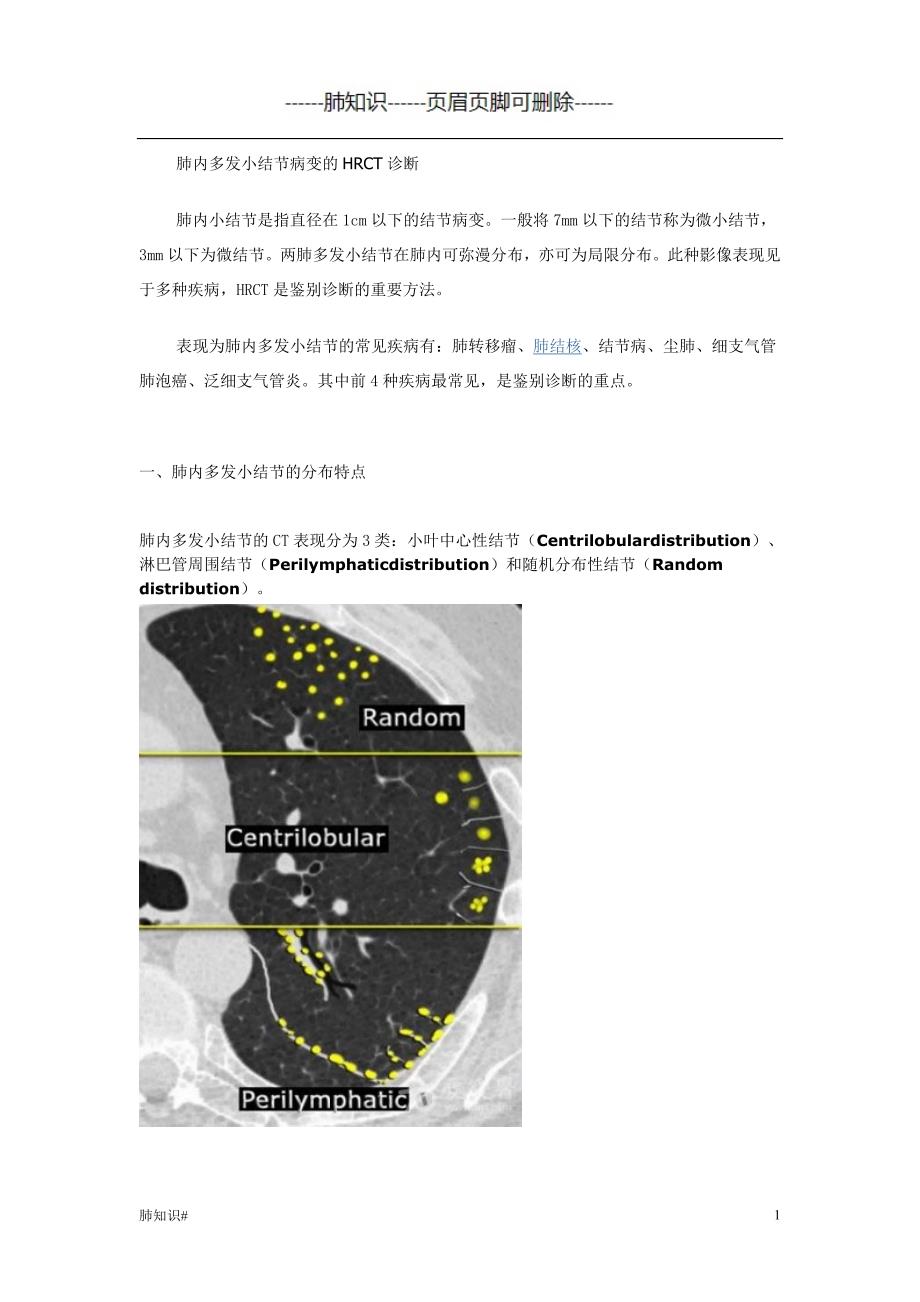 肺内多发小结节病变的HRCT诊断#肺相关类_第1页