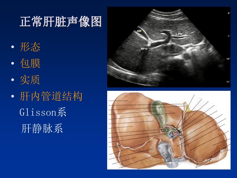 肝脏解剖超声ppt课件_第4页