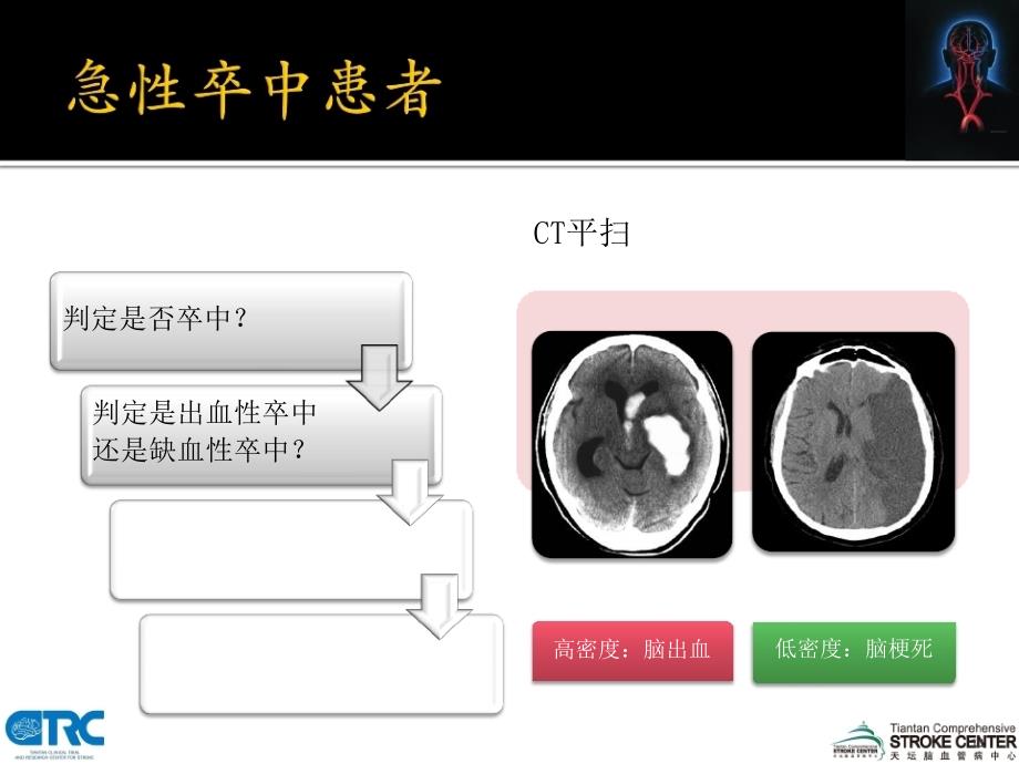 王拥军缺血性卒中诊断思路_第4页