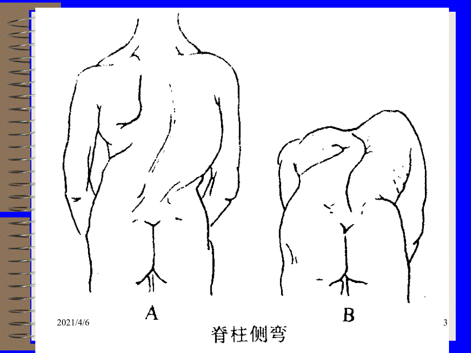 脊柱脊髓损伤的体格检查文档资料_第3页