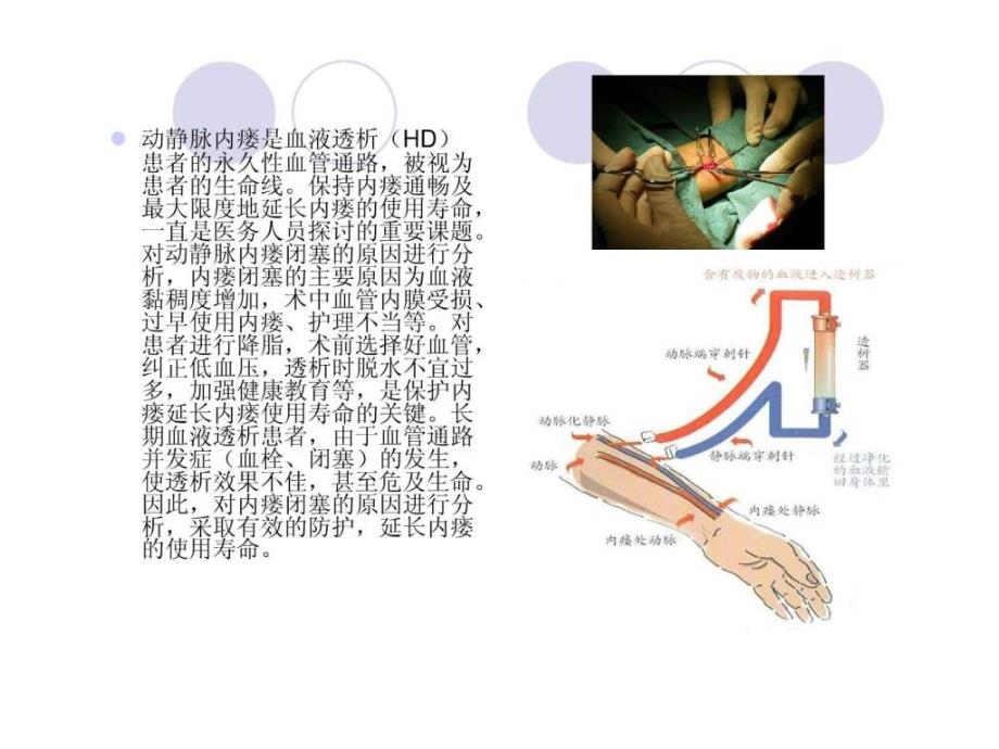 血液透析患者动静脉内瘘闭塞的原因及防护.ppt_第2页