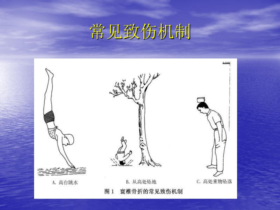 成人急性寰椎骨折循证临床诊疗指南_第4页