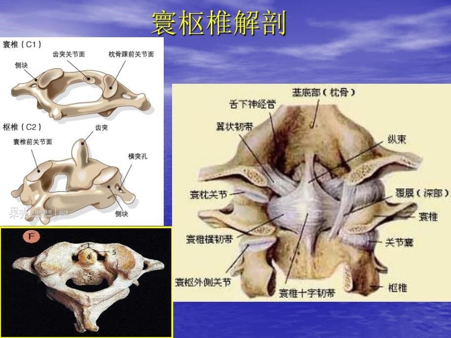 成人急性寰椎骨折循证临床诊疗指南_第5页