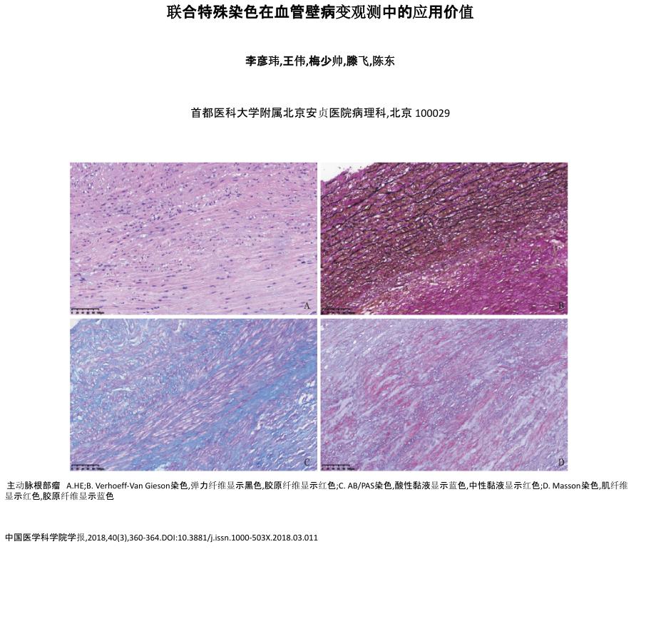 联合特殊染色在血管壁病变观测中的应用价值_第1页