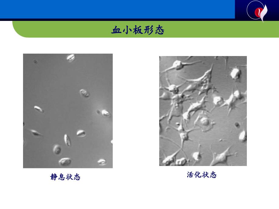 血小板抗原抗体检测及其输血科应用PPT课件_第4页