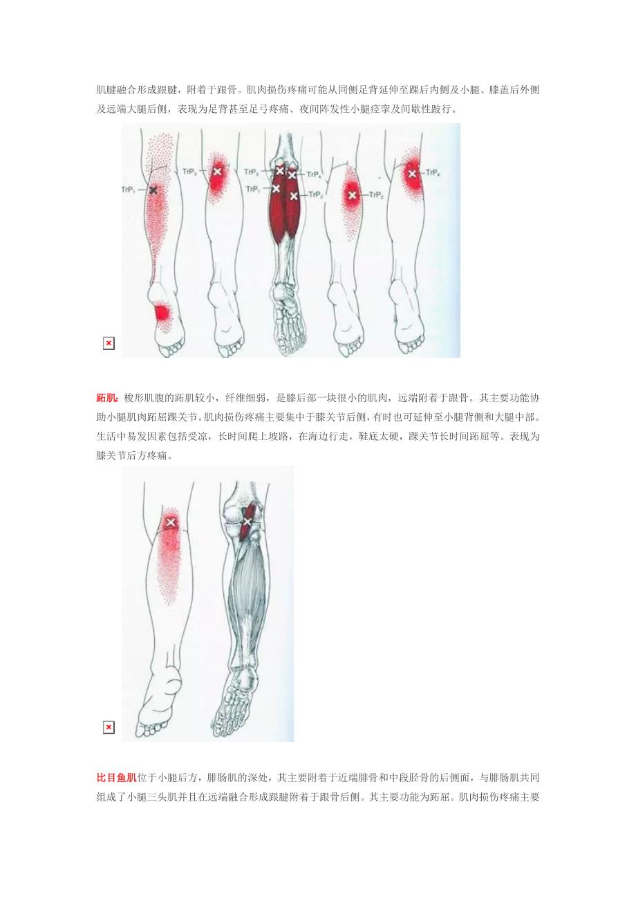 腘窝处疼痛的常见原因.doc_第5页