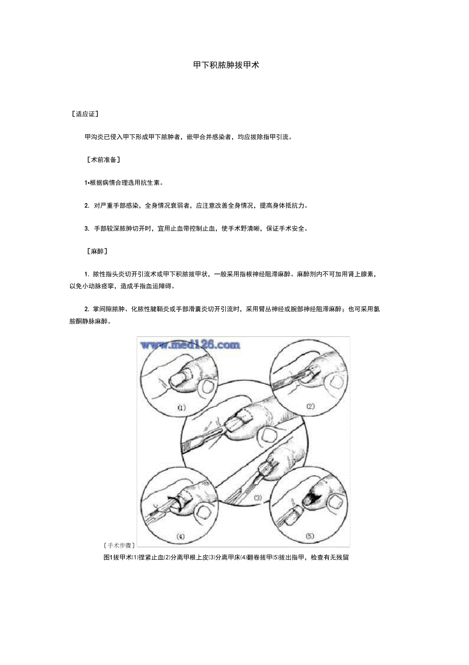 拔甲基本操作流程_第1页