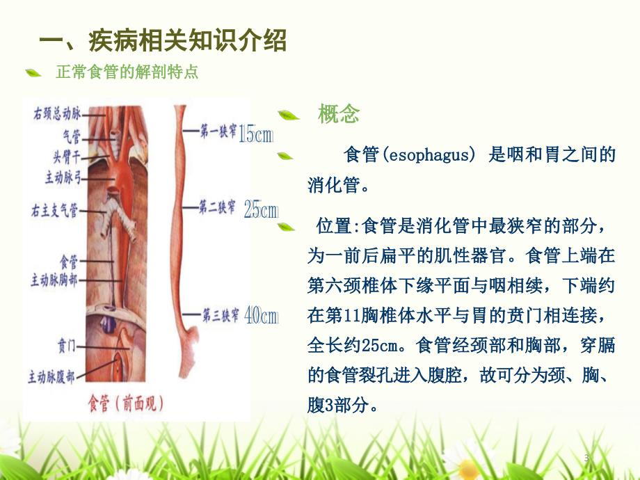 食道癌个案查房ppt课件_第3页