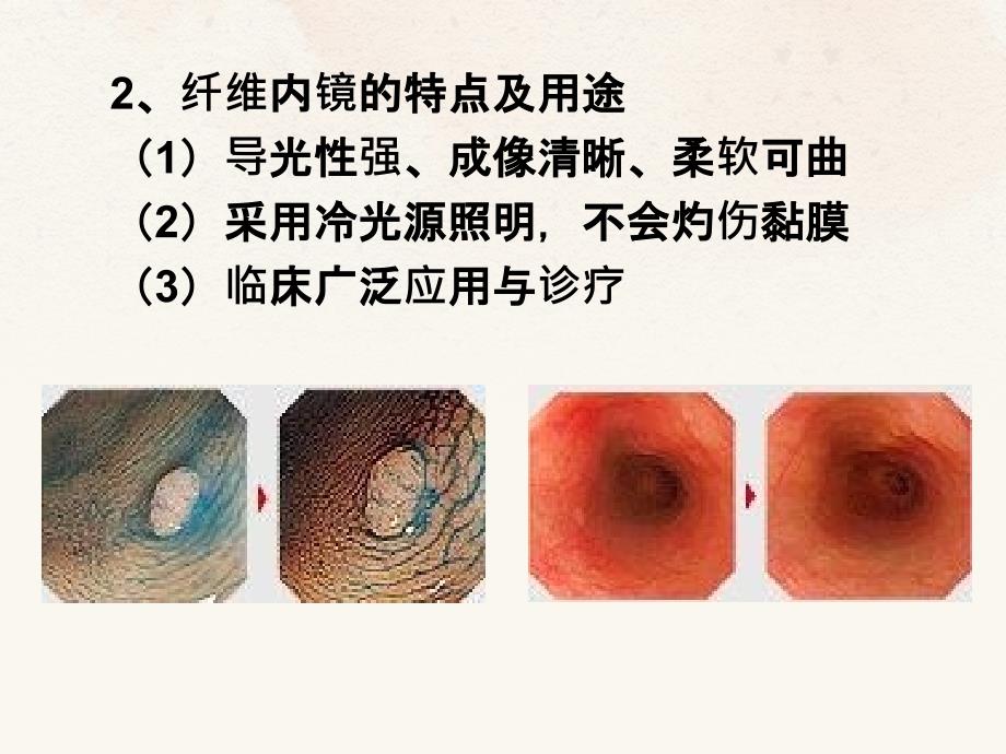 第七节纤维内镜检查_第3页