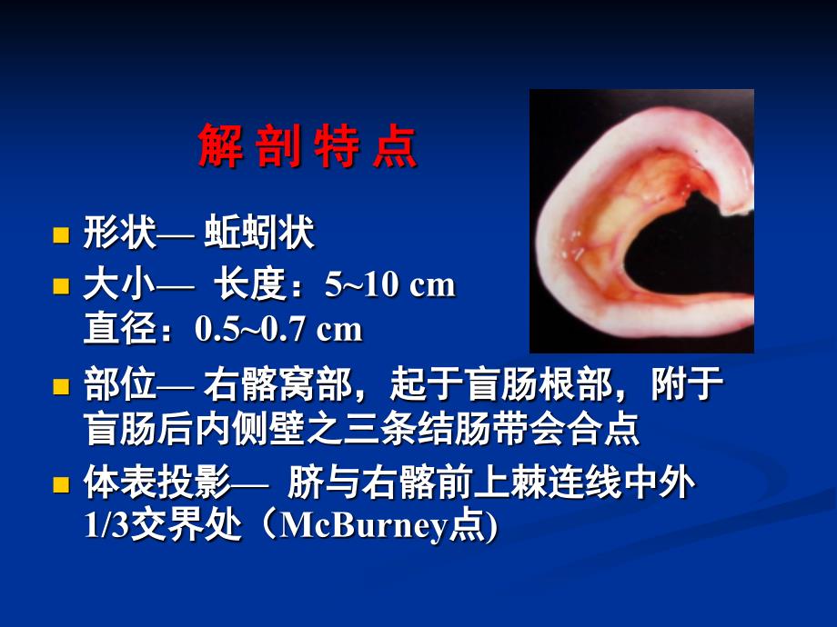 外科PPT课件8.阑尾疾病ppt_第3页