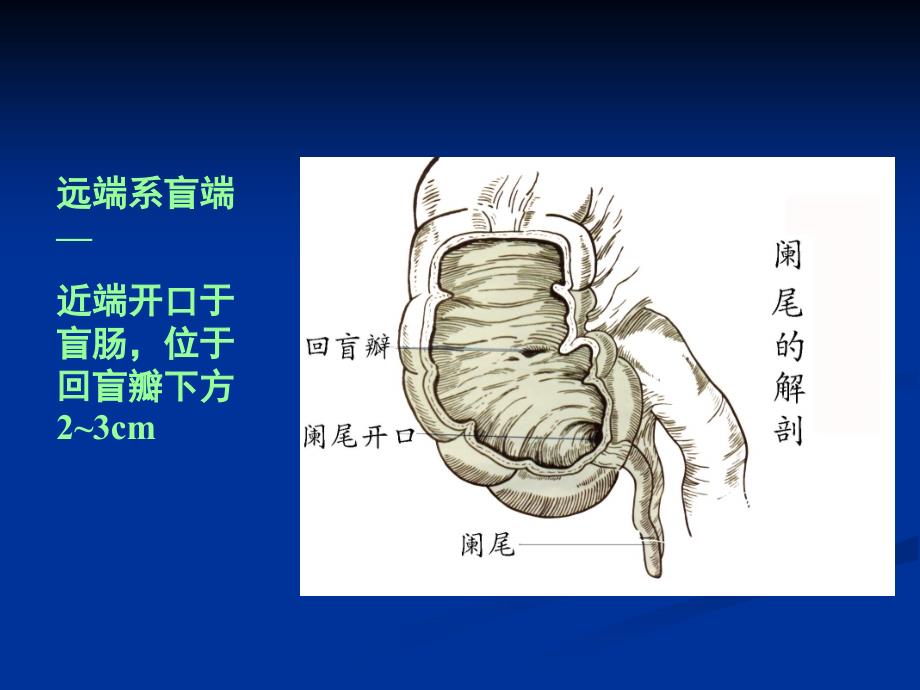 外科PPT课件8.阑尾疾病ppt_第4页