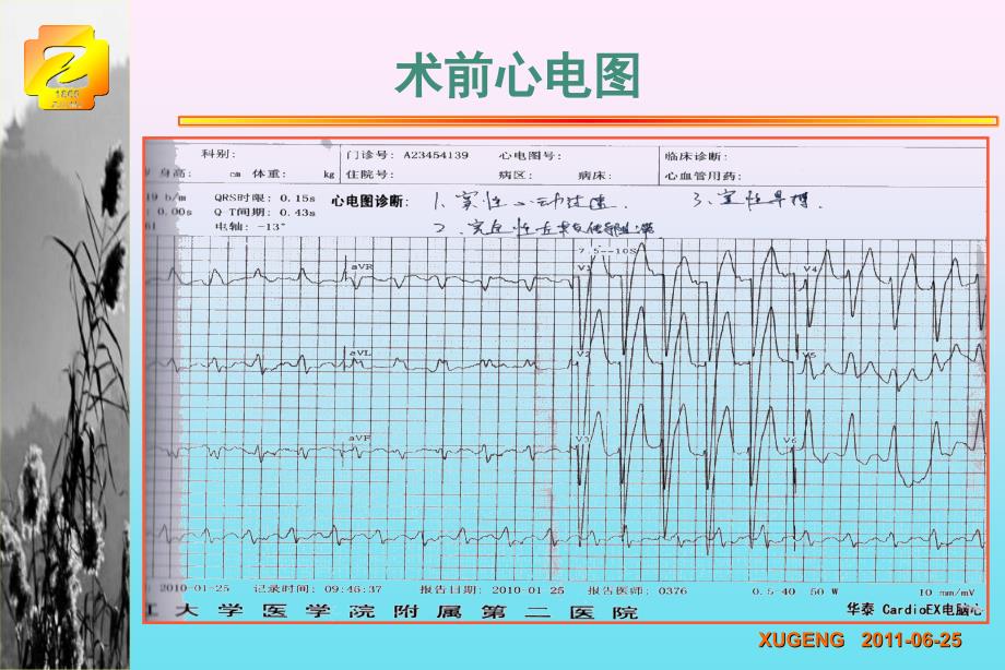 轻度心衰CRT时机已经来到最新循证医学证读_第4页