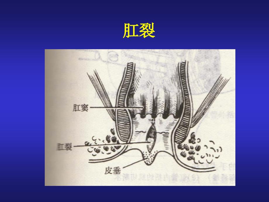 肛门直肠检查方法_第4页