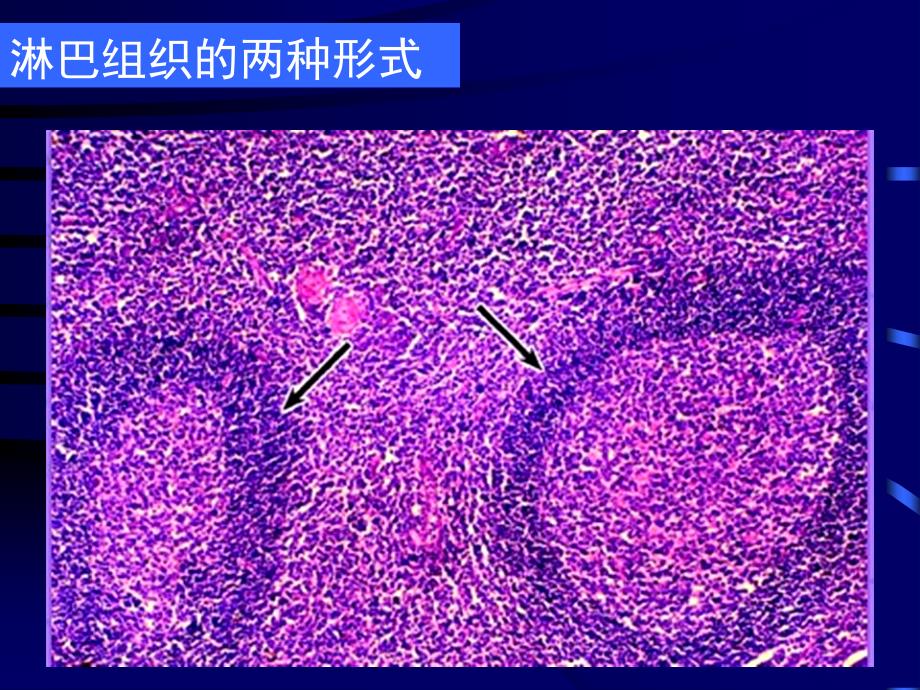 免疫系统组织胚胎学教学课件_第4页