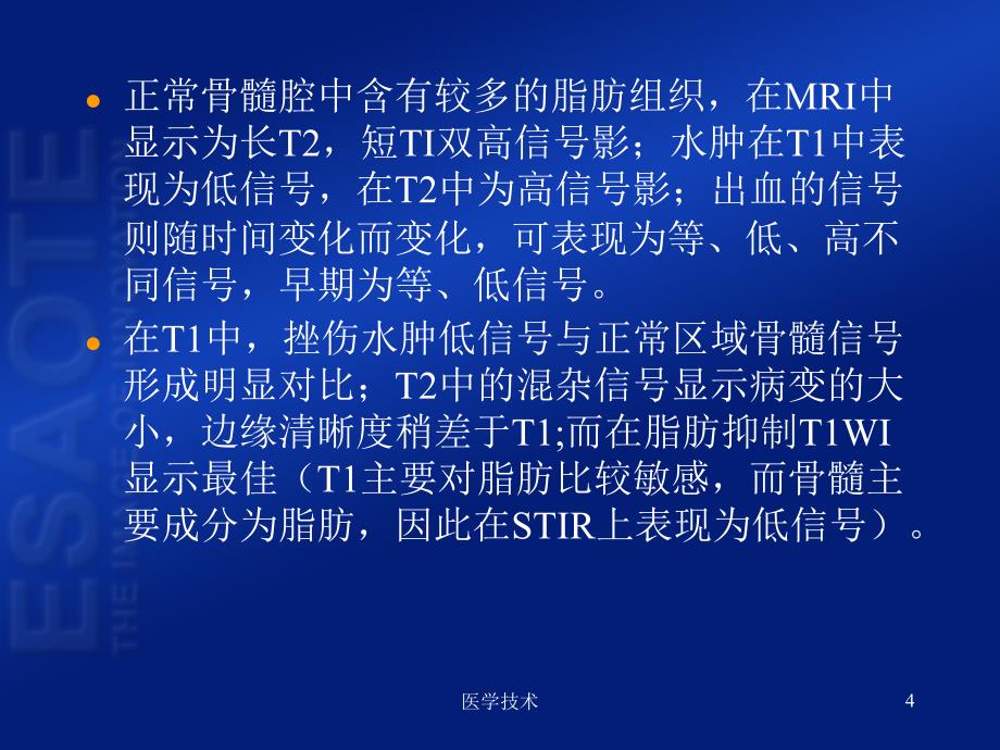 骨挫伤含骨损伤的形成机制及好发部位医学技术_第4页