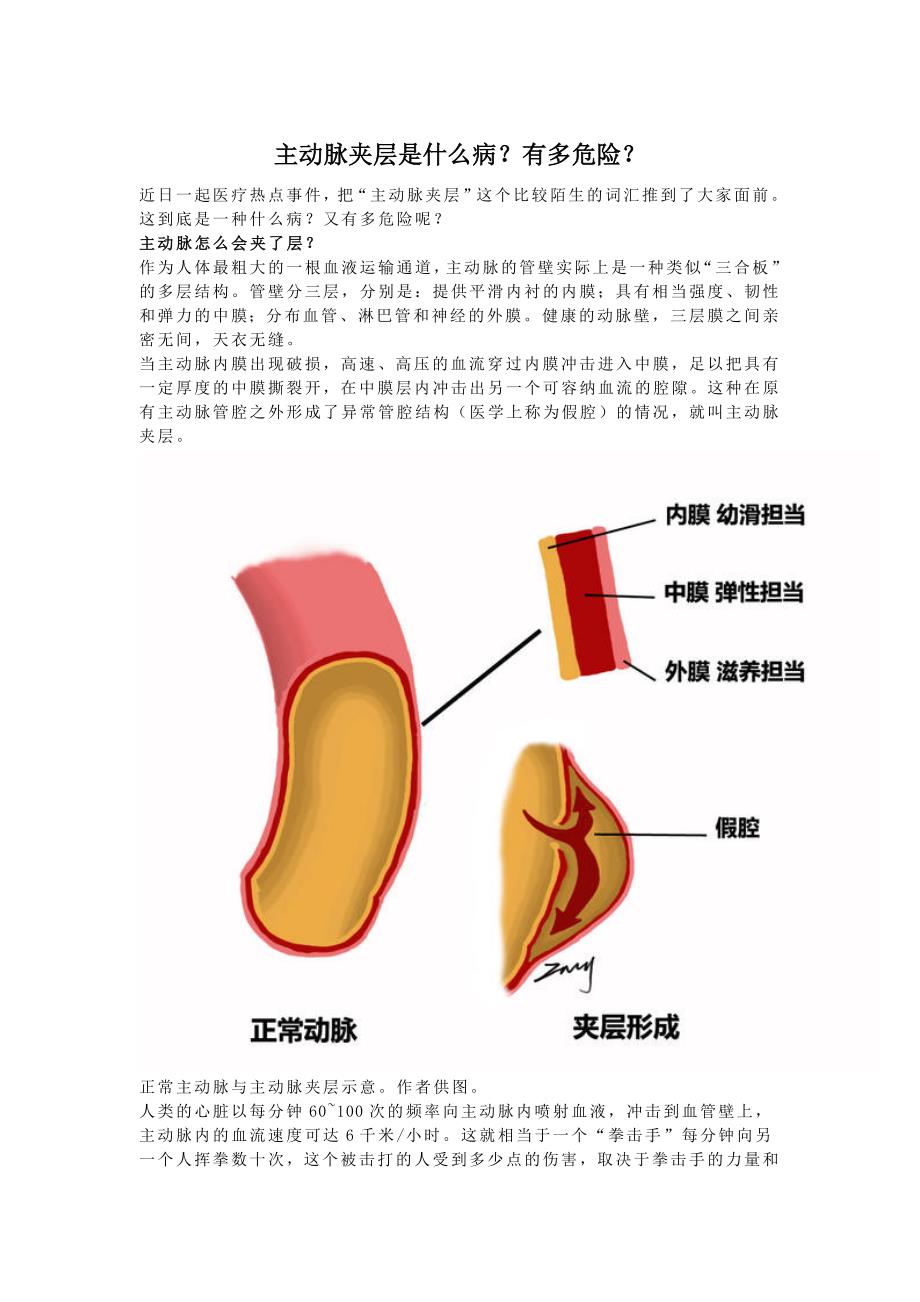 主动脉夹层是什么病？有多危险？_第1页