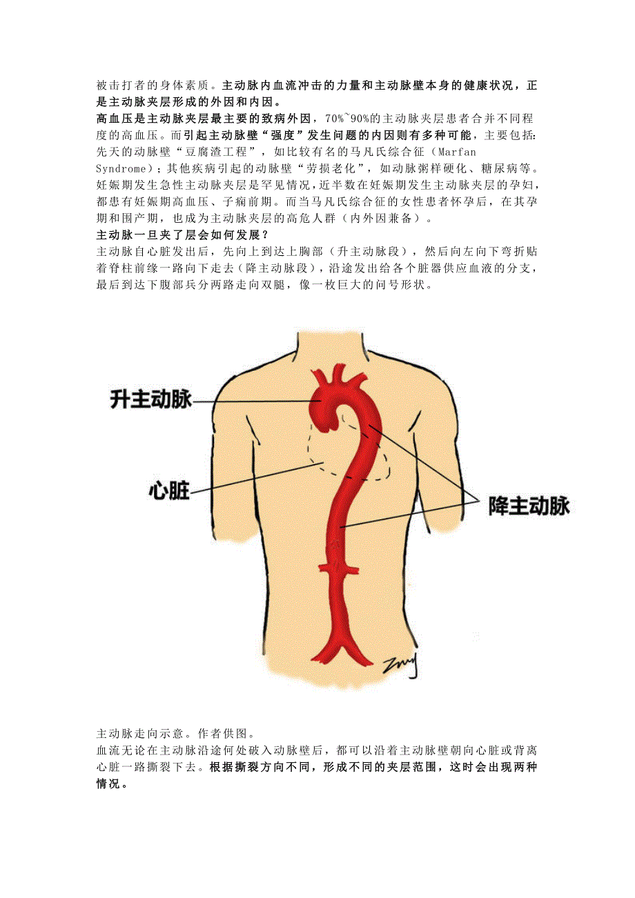 主动脉夹层是什么病？有多危险？_第2页