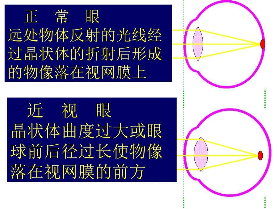 视觉的调节PPT课件_第5页