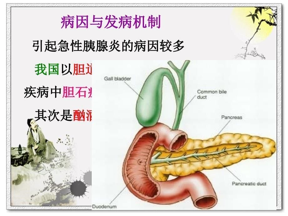 7第七节急性胰腺炎病人的护理汇总_第5页