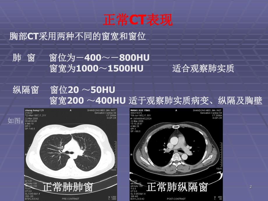 正常胸肺部CT影像学表现优秀课件_第2页