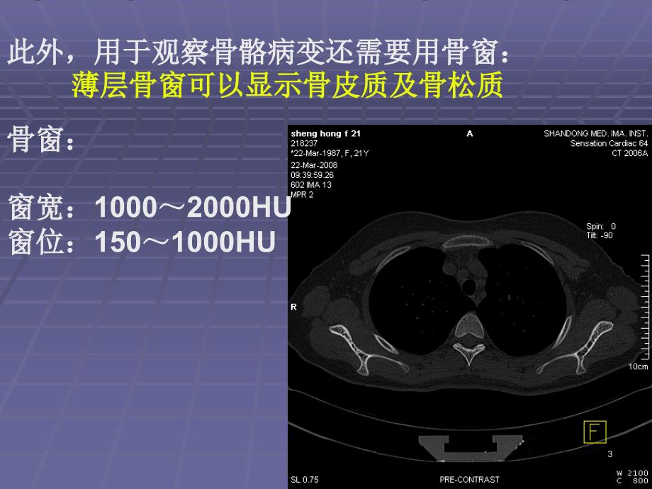 正常胸肺部CT影像学表现优秀课件_第3页