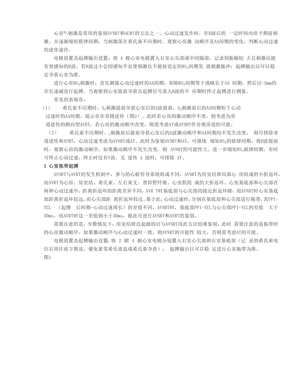 室上性心动过速鉴别诊断的常用心内电生理程序刺激方法_第2页